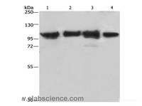 Western Blot analysis of Lovo cell and Mouse kidney tissue, 231 and hepG2 cell using ACTN4 Polyclonal Antibody at dilution of 1:485