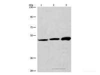 Western Blot analysis of adrenal pheochromocytoma tissue, Jurkat and A549 cell using VWA5A Polyclonal Antibody at dilution of 1:275