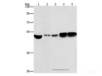 Western Blot analysis of Hela and A431 cell, Mouse brain and liver tissue, Mouse pancreas tissue using ENO1 Polyclonal Antibody at dilution of 1:500