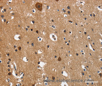 Immunohistochemistry of paraffin-embedded Human brain using CD27 Polyclonal Antibody at dilution of 1:60