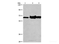 Western Blot analysis of 231 cell, Mouse kidney and liver tissue using CHDH Polyclonal Antibody at dilution of 1:500