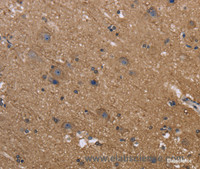 Immunohistochemistry of paraffin-embedded Human brain using c-Rel Polyclonal Antibody at dilution of 1:50