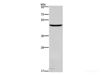 Western Blot analysis of Human testis tissue using DMRT3 Polyclonal Antibody at dilution of 1:550