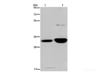 Western Blot analysis of Human fetal brain and Mouse brain tissue using MAPRE3 Polyclonal Antibody at dilution of 1:500