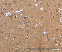 Immunohistochemistry of paraffin-embedded Human brain tissue using KIAA1324 Polyclonal Antibody at dilution 1:30