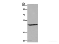 Western Blot analysis of Mouse brain tissue using ETS2 Polyclonal Antibody at dilution of 1:500