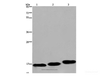 Western Blot analysis of Mouse skeletal muscle, heart and bladder tissue using MYL12B Polyclonal Antibody at dilution of 1:550