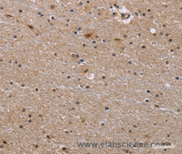 Immunohistochemistry of paraffin-embedded Human brain tissue using GABPB2 Polyclonal Antibody at dilution 1:30