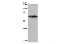 Western Blot analysis of Human fetal liver tissue using GALT Polyclonal Antibody at dilution of 1:300
