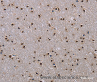 Immunohistochemistry of paraffin-embedded Human brain using JMJD6 Polyclonal Antibody at dilution of 1:40