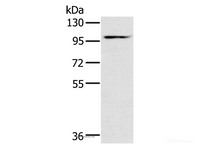 Western Blot analysis of Mouse heart tissue using KCNQ5 Polyclonal Antibody at dilution of 1:500