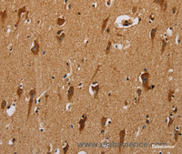 Immunohistochemistry of paraffin-embedded Human brain using NDUFS3 Polyclonal Antibody at dilution of 1:40