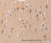 Immunohistochemistry of paraffin-embedded Human brain using OTUB1 Polyclonal Antibody at dilution of 1:40