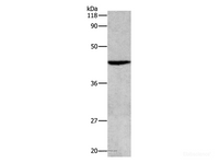 Western Blot analysis of Hela cell using ATG4B Polyclonal Antibody at dilution of 1:500