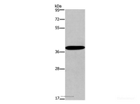 Western Blot analysis of Mouse skin tissue using CD192 Polyclonal Antibody at dilution of 1:450