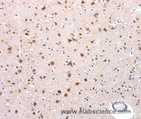 Immunohistochemistry of paraffin-embedded Human brain tissue using NDUFA12 Polyclonal Antibody at dilution 1:50