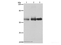 Western Blot analysis of Human cervical cancer, legs fibrous histiocytoma and fetal brain tissue using NECTIN1 Polyclonal Antibody at dilution of 1:400