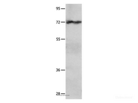 Western Blot analysis of Hela cell using IGF2BP1 Polyclonal Antibody at dilution of 1:750