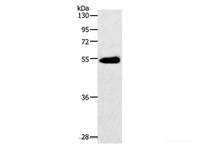 Western Blot analysis of Human colon cancer tissue using GLUT-3 Polyclonal Antibody at dilution of 1:400