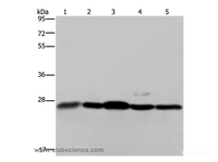 Western Blot analysis of Human hepatocellular carcinoma tissue, Hela and Jurkat cell, 293T cell and Human breast infiltRative duct tissue using HMGB1 Polyclonal Antibody at dilution of 1:200