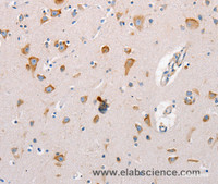 Immunohistochemistry of paraffin-embedded Human brain tissue using MTOR Polyclonal Antibody at dilution 1:60