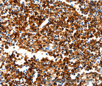 Immunohistochemistry of paraffin-embedded Human tonsil tissue using NCOR1 Polyclonal Antibody at dilution 1:100