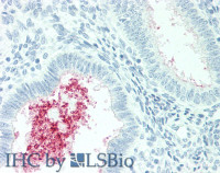 Immunohistochemistry of paraffin-embedded Human Uterus tissue using SLC34A2 Polyclonal Antibody at dilution of 1:60 (Elabscience® Product Detected by Lifespan) .