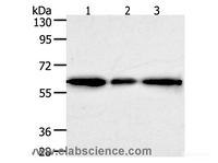 Western Blot analysis of Human liver cancer tissue, hela and 293T cell using AKR1A1 Polyclonal Antibody at dilution of 1:500