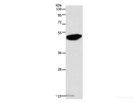 Western Blot analysis of Jurkat cell using ENO2 Polyclonal Antibody at dilution of 1:750