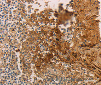Immunohistochemistry of paraffin-embedded Human tonsil using ADCYAP1R1 Polyclonal Antibody at dilution of 1:70
