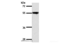 Western Blot analysis of Mouse eye tissue using SLC32A1 Polyclonal Antibody at dilution of 1:500