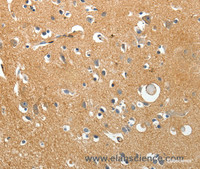 Immunohistochemistry of paraffin-embedded Human brain using AKAP12 Polyclonal Antibody at dilution of 1:40