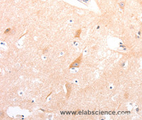 Immunohistochemistry of paraffin-embedded Human brain tissue using CELSR2 Polyclonal Antibody at dilution 1:50