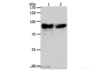 Western Blot analysis of Mouse heart tissue and hela cell using ACO2 Polyclonal Antibody at dilution of 1:400