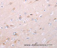 Immunohistochemistry of paraffin-embedded Human brain tissue using ADCY5 Polyclonal Antibody at dilution 1:40