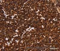Immunohistochemistry of paraffin-embedded Human tonsil tissue using ALG11 Polyclonal Antibody at dilution 1:40