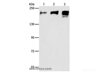 Western Blot analysis of Human ileum adenocarcinoma tissue, Human testis and prostate tissue using ACE1 Polyclonal Antibody at dilution of 1:240