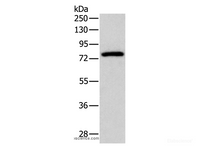 Western Blot analysis of Mouse brain tissue using PKC gamma Polyclonal Antibody at dilution of 1:500