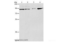 Western Blot analysis of Raji, A549, A431 and K562 cell using PI 3 kinase p85 beta Polyclonal Antibody at dilution of 1:233
