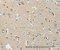 Immunohistochemistry of paraffin-embedded Human brain using SERPINA9 Polyclonal Antibody at dilution of 1:60