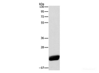 Western Blot analysis of Human leiomyosarcoma tissue using CAV1 Polyclonal Antibody at dilution of 1:525