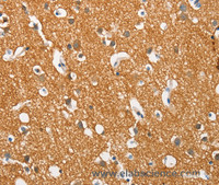 Immunohistochemistry of paraffin-embedded Human brain tissue using SNCA Polyclonal Antibody at dilution 1:60