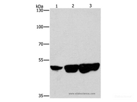 Western Blot analysis of Hela, hepG2 and 231 cell using CTBP2 Polyclonal Antibody at dilution of 1:400
