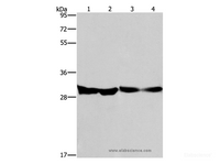 Western Blot analysis of Human endometrial carcinoma and colon cancer tissue, Mouse heart tissue and PC3 cell using DECR1 Polyclonal Antibody at dilution of 1:300