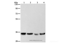Western Blot analysis of Hela, hepG2, A549 and 293T cell using AIMP1 Polyclonal Antibody at dilution of 1:400