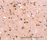 Immunohistochemistry of paraffin-embedded Human brain using GH1 Polyclonal Antibody at dilution of 1:40
