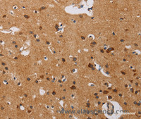 Immunohistochemistry of paraffin-embedded Human brain using IL17RA Polyclonal Antibody at dilution of 1:40