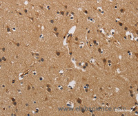 Immunohistochemistry of paraffin-embedded Human brain using FABP2 Polyclonal Antibody at dilution of 1:40