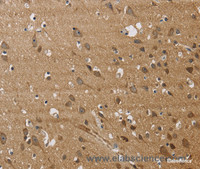 Immunohistochemistry of paraffin-embedded Human brain tissue using JAG1 Polyclonal Antibody at dilution 1:40