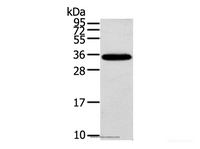 Western Blot analysis of Mouse brain tissue using KCNMB3 Polyclonal Antibody at dilution of 1:300